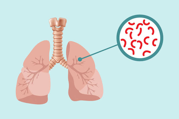 Enhanced TB Training for Health care Workers
